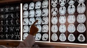 Neurology
